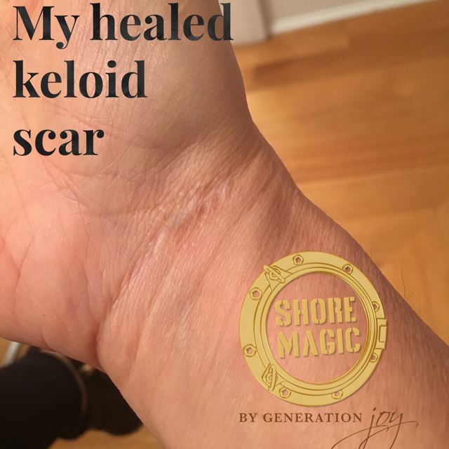 Can My Scars Ever Heal?