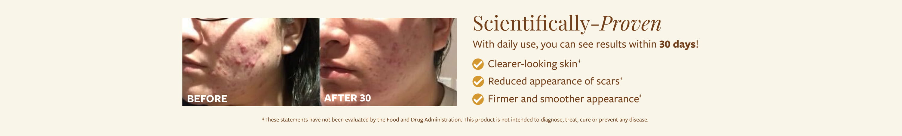 Women before and after photos with focus on acne scars